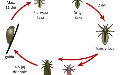 Jak rozmnażają się wszy? Cykl życia i jak go przerwać
